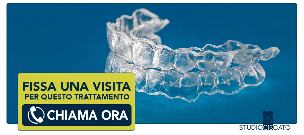 ortodonzia-invisalign Verona