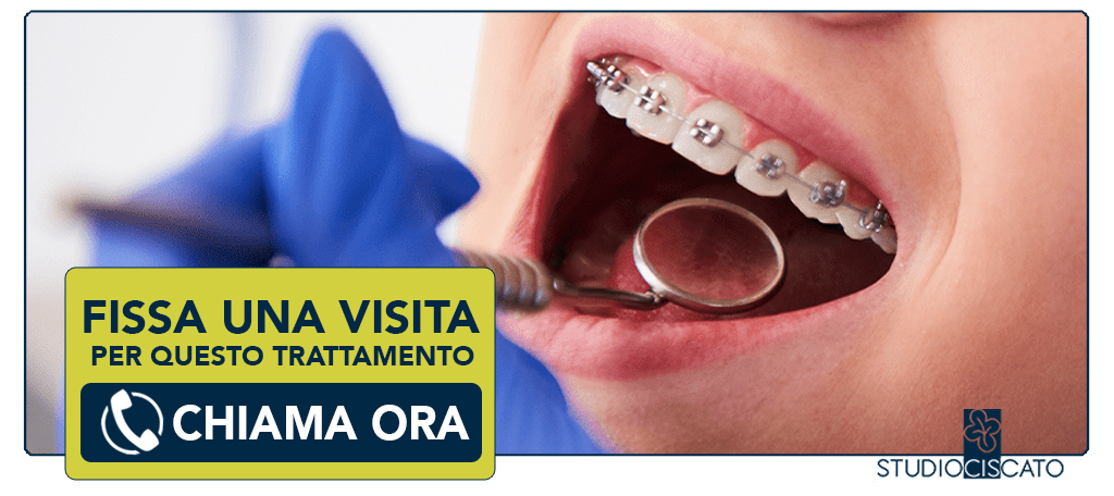 ortodonzia-nell-adulto Verona